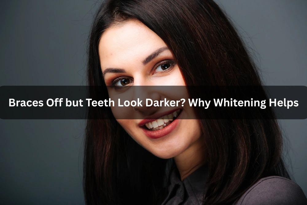 Braces Off but Teeth Look Darker? Why Whitening Helps