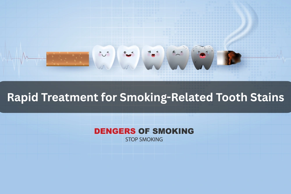 Rapid Treatment for Smoking-Related Tooth Stains