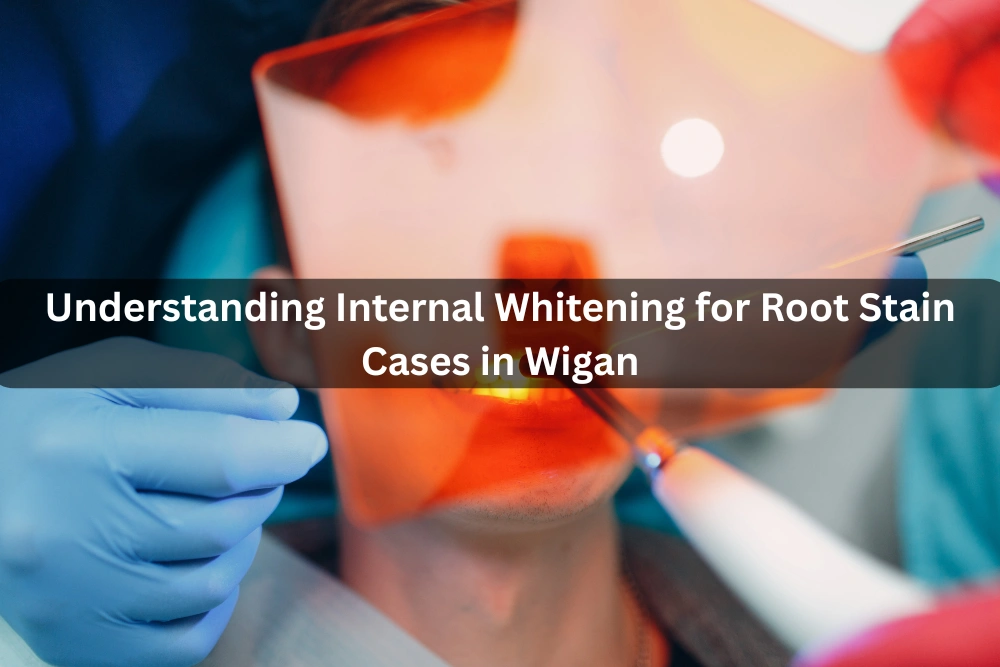 Understanding Internal Whitening for Root Stain Cases in Wigan