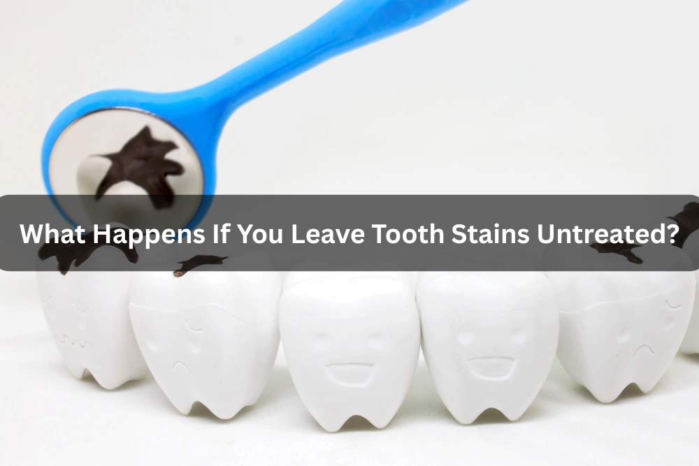 What Happens If You Leave Tooth Stains Untreated?